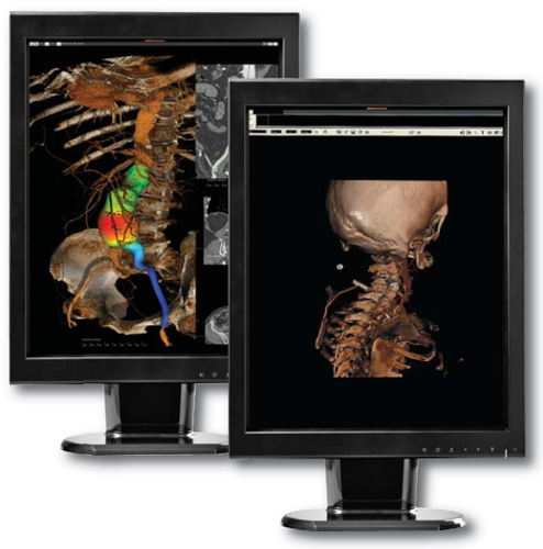 Canvys Color Image Systems CX2MP