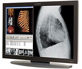 Dome E4C with Matrox Card & Protective Glass