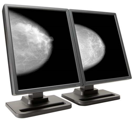 Dual Head 5MP Dome E5 Grayscale Radiology Display