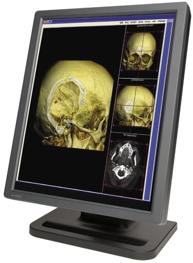 3MP Dome E3cHB Color Radiology Display