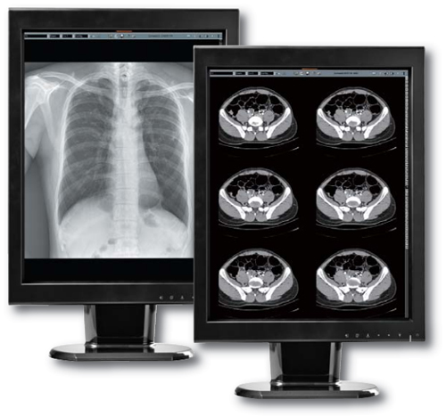 Canvys Grayscale Image Systems MX2MP