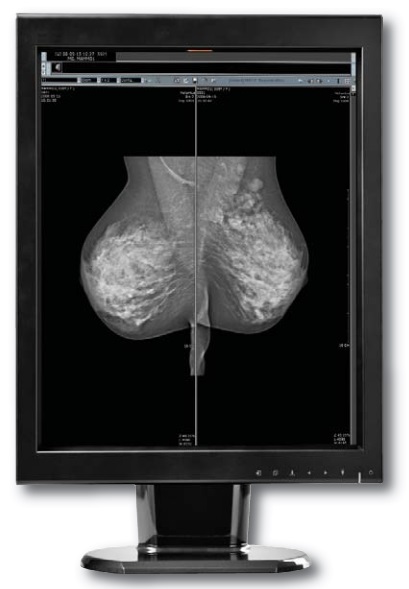 Canvys Grayscale Image Systems MX5MP